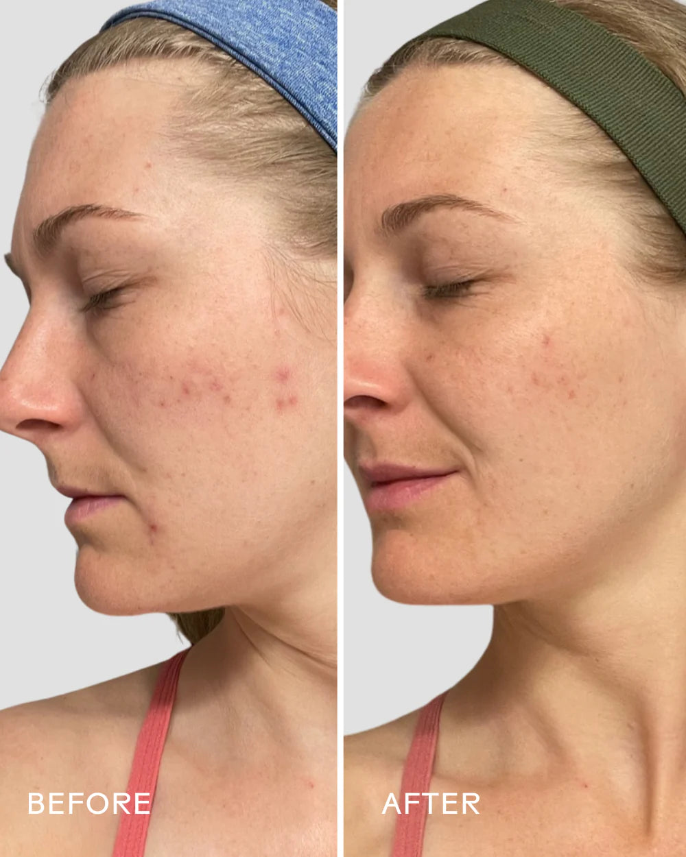 Three Ships Refresh Papaya + Salicylic Acid Foaming Cleanser
