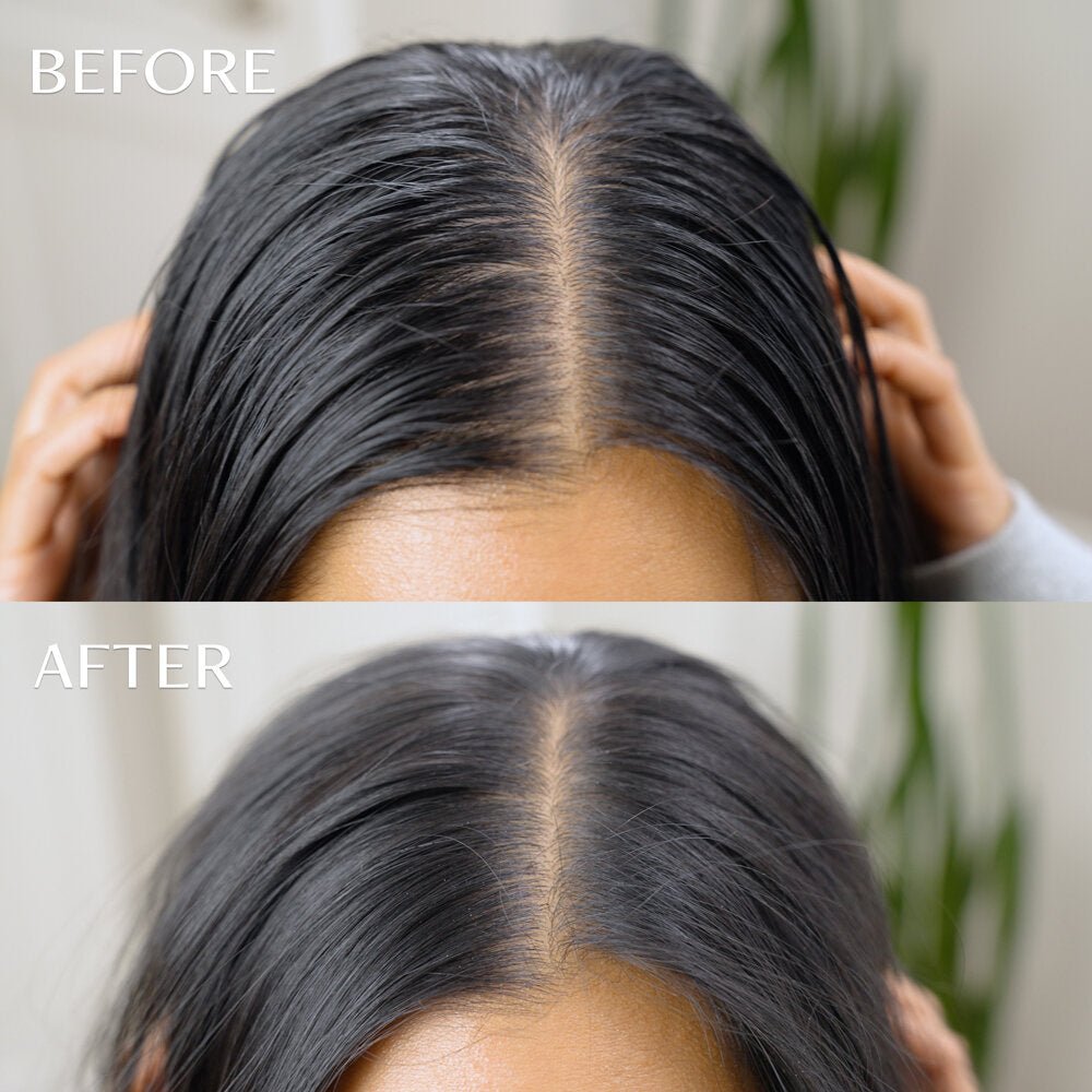 m'Chel Day After™ Brush Refill - Aesthetics By Kell