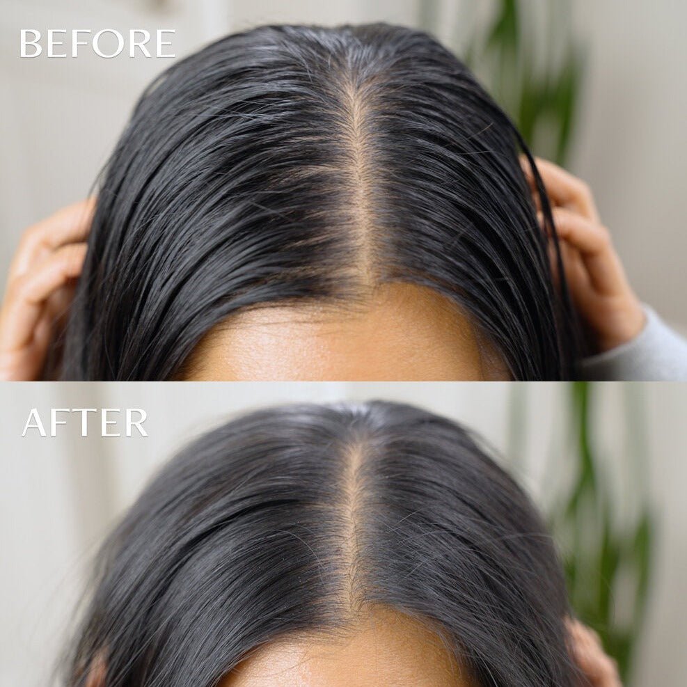 m'Chel Day After™ Brush + Refill Bundle Clean Dry Shampoo - Aesthetics By Kell