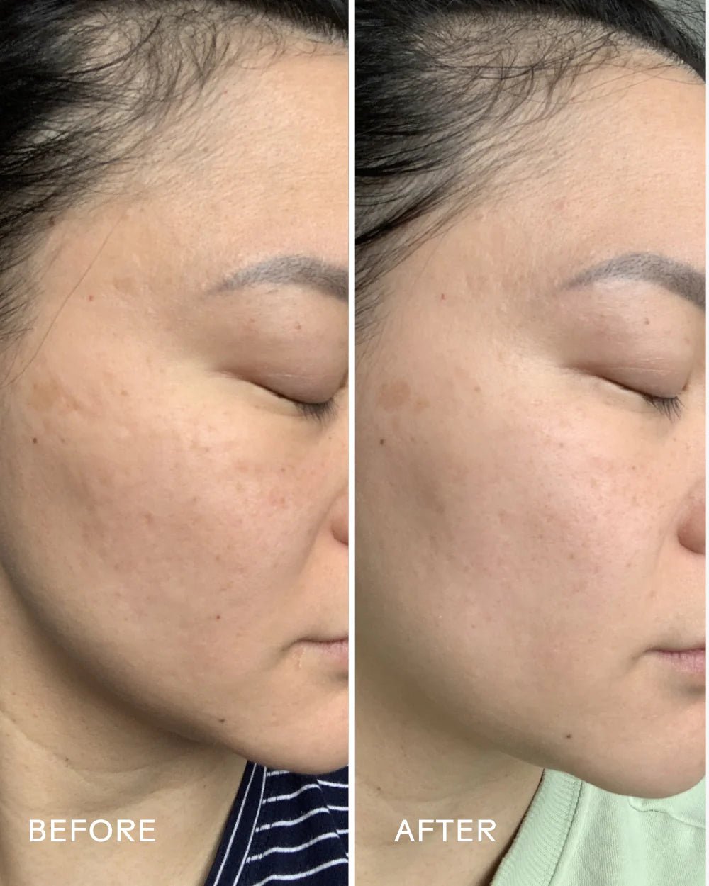 Three Ships Dew Drops Mushroom Hyaluronic Acid + Vitamin C Serum - Aesthetics By Kell