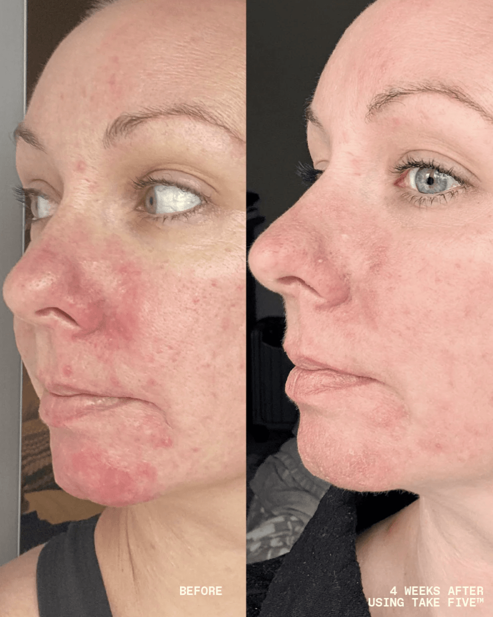 Three Ships Take Five™ Hypochlorous Acid Balancing Body + Face Spray - Aesthetics By Kell